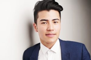 The Advantages of Hair Transplant